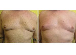 BodyFX 01 sm