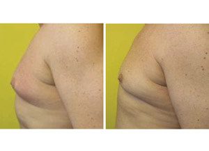 BodyFX 02 sm
