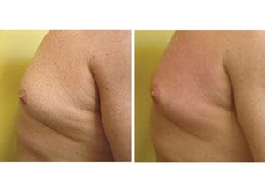 BodyFX 03 sm