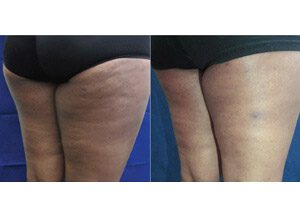 BodyFX 6 sm