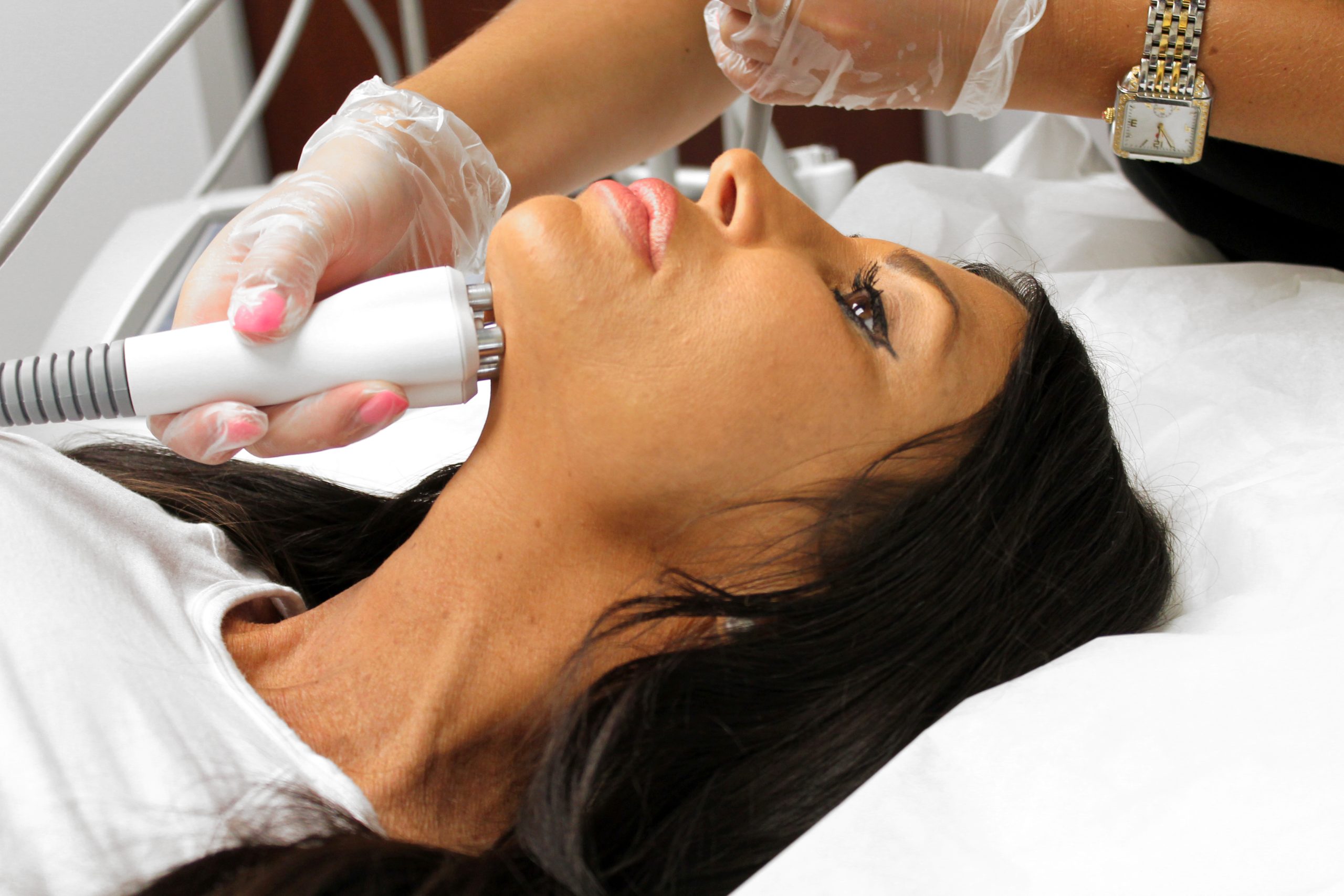Laser Dark Spot Removal scaled