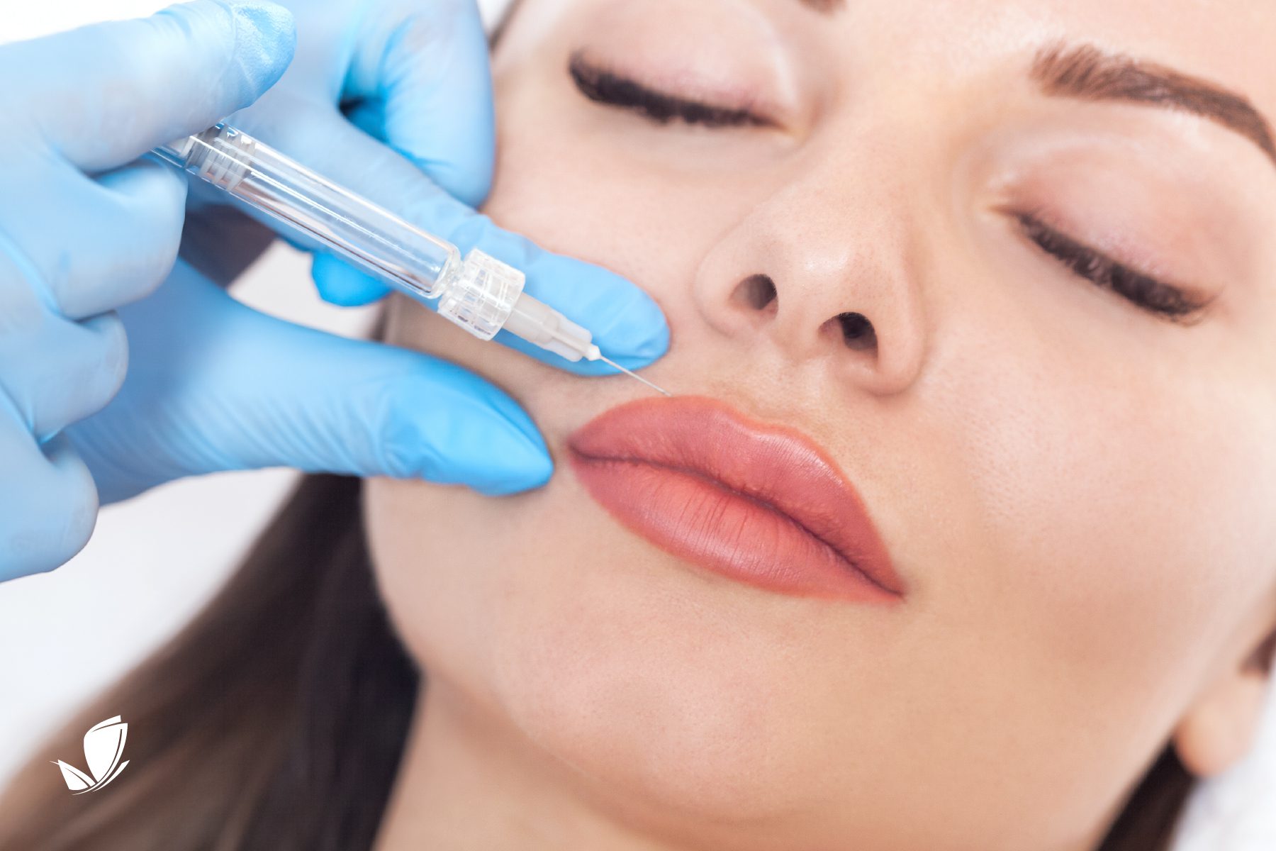 LightRx June How Long Does Lip Filler Last